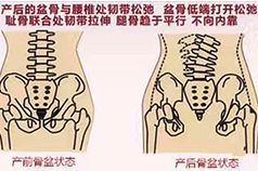 女性盆底解剖常识