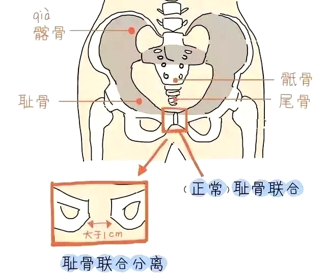 盆底肌康复治疗仪，产后妈妈不再担心