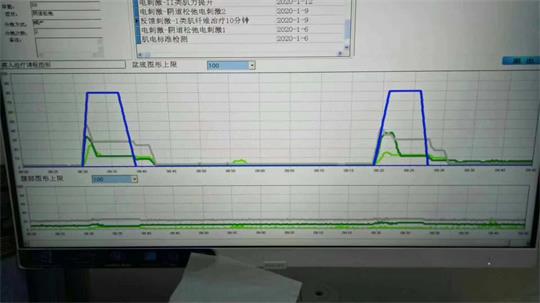 AG旗舰中心子宫复旧治疗仪器，痛经不再是问题