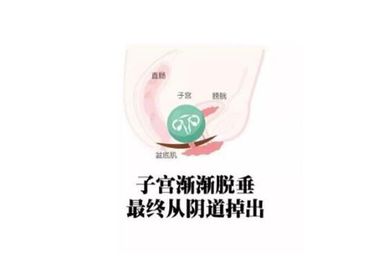 产后康复综合治疗仪|祝贺妇科门诊引进专业的产康仪器