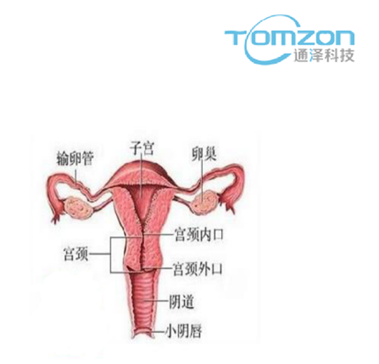 关注产后女性健康，子宫修复仪器的重要性