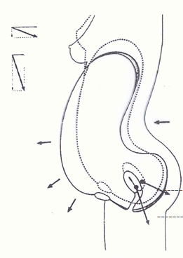 腹直肌分离仪器